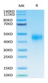 SDS-PAGE (TFPI-646HB).jpg